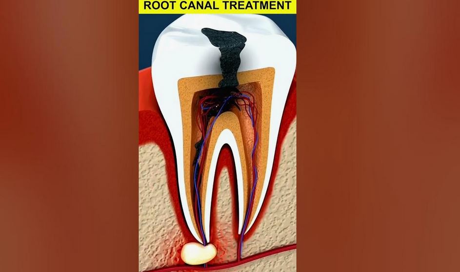 rootde