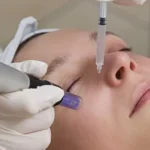 Salmon-DNA-with-microneedling