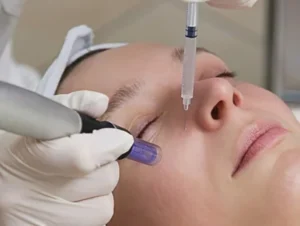 Salmon-DNA-with-microneedling