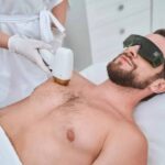 laser hair removal Edmonton